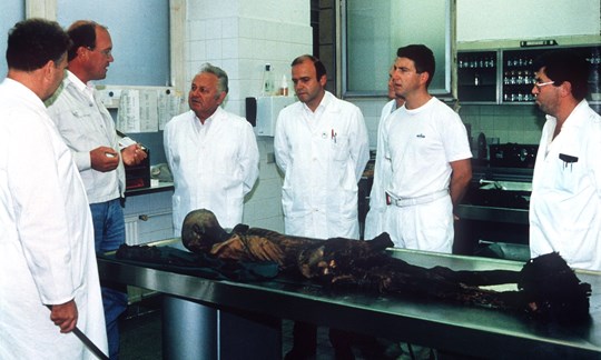 Professor Konrad Spindler (2.v.l) untersucht mit einem internationalen Team von Wissenschaftlern im September 1991 erstmals die Mumie.